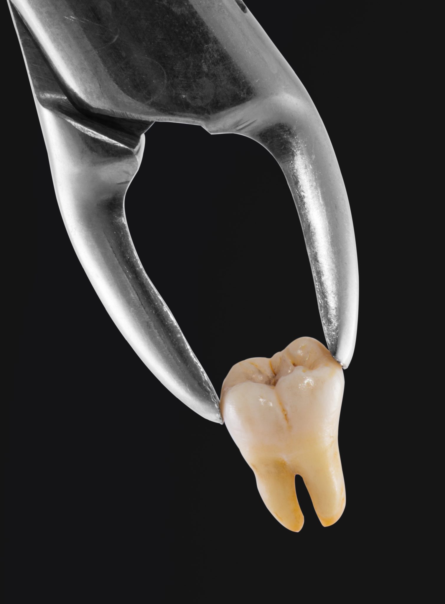 Simple Tooth Extraction Guide: A Step-by-Step Overview