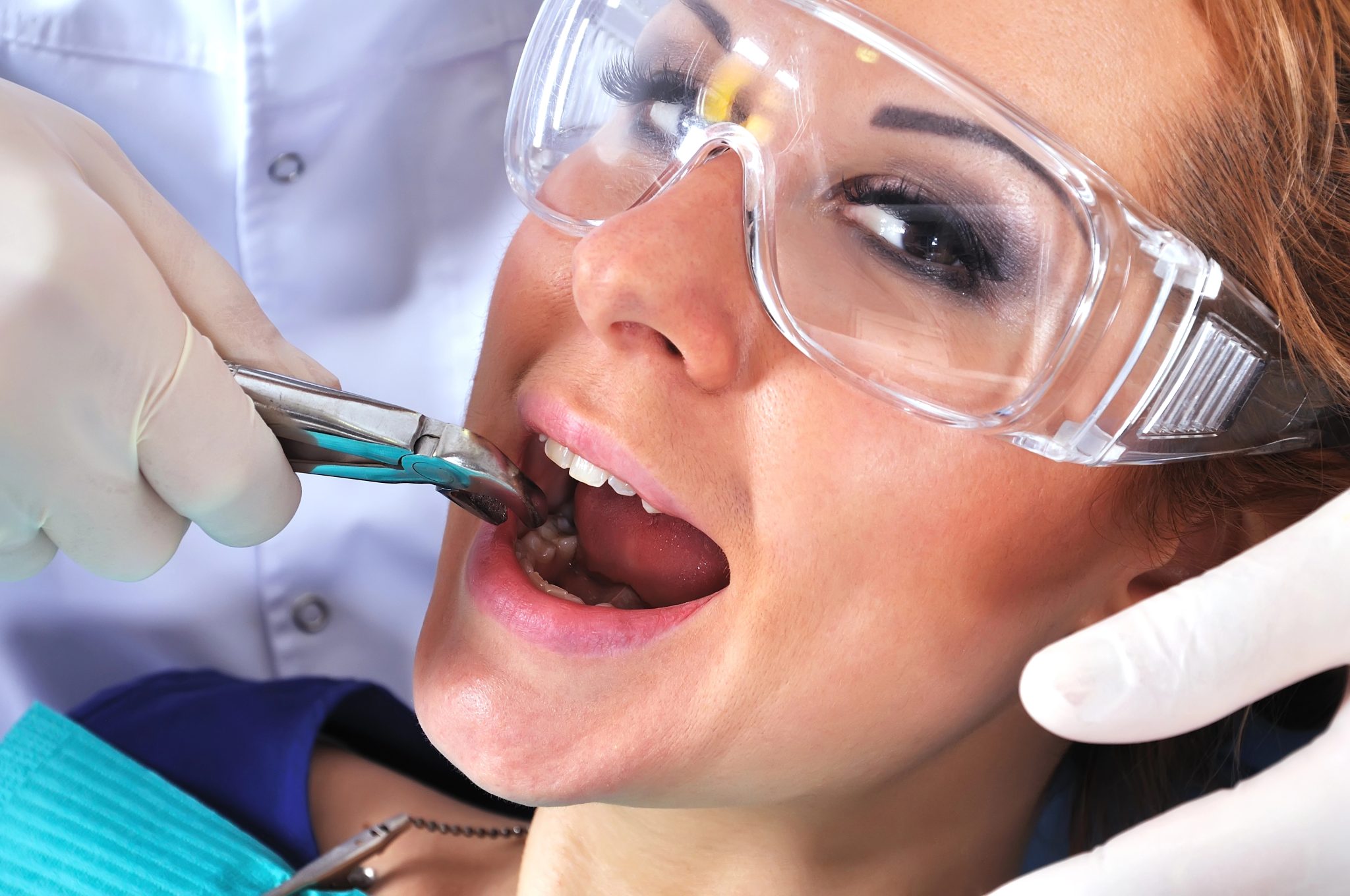 Benefits of Tooth Extraction: Why It May Be the Best Option